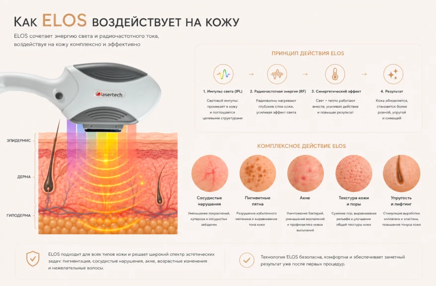 Технология ELOS