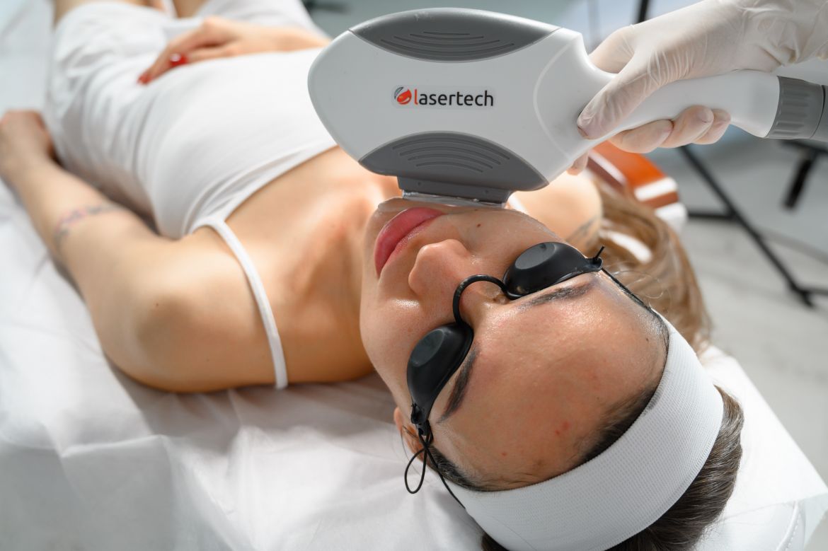  ELOS (Electro Optical Synergy)