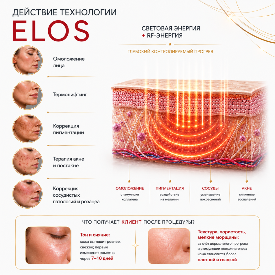  ELOS (Electro Optical Synergy)